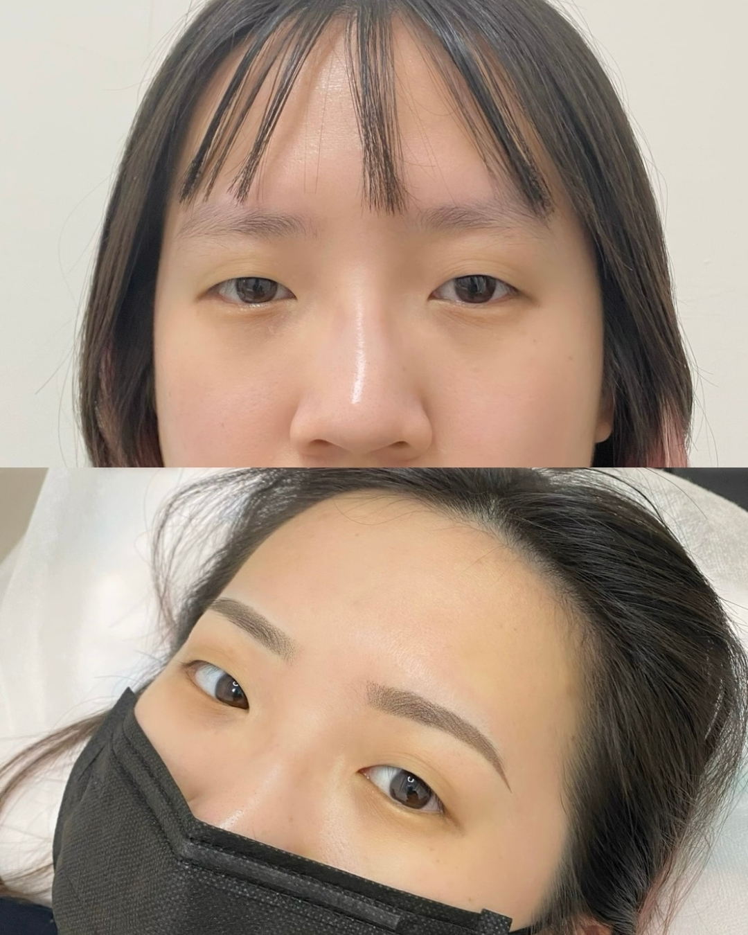 前後對比 案例